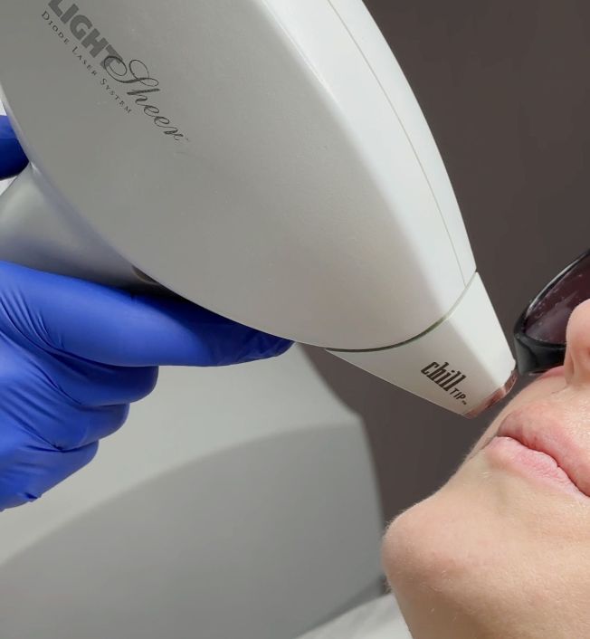 Волоски на обличчі має кожна жінка - і це нормально image