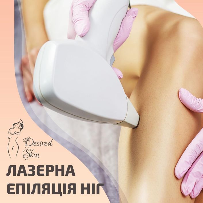 Лазерна епіляція ніг image
