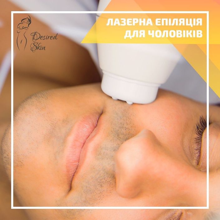 Лазерна епіляція для чоловіків image