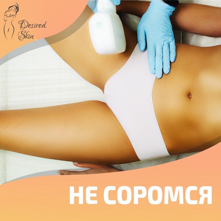 Лазерна епіляція на інтимних ділянках шкіри image