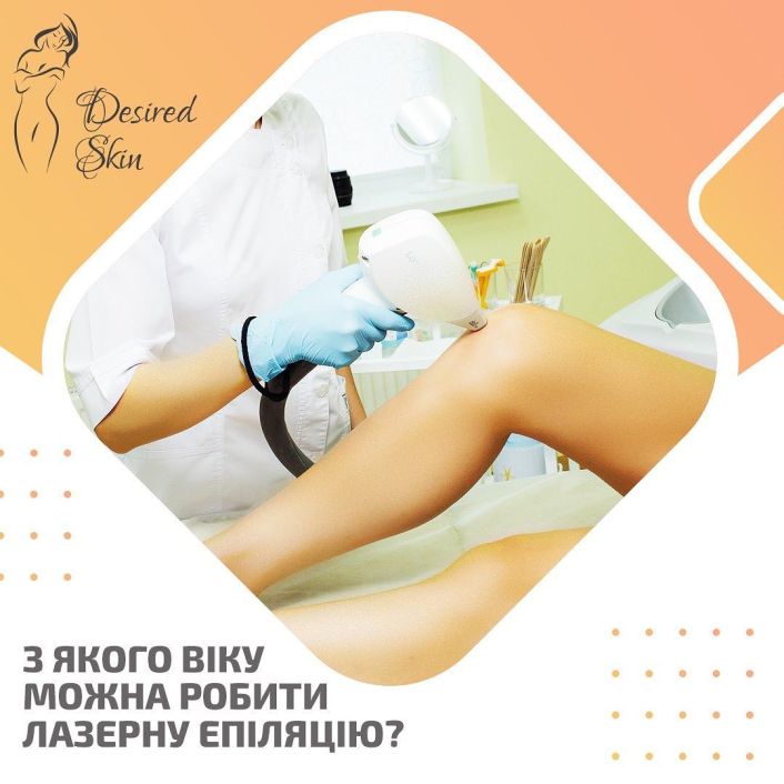З якого віку можна робити лазерну епіляцію image