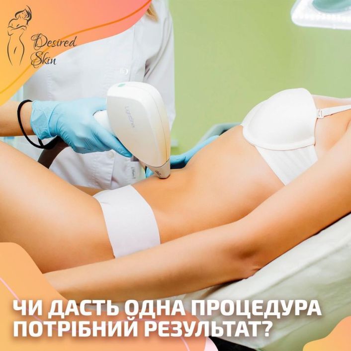 Чи дасть одна процедура потрібний результат image