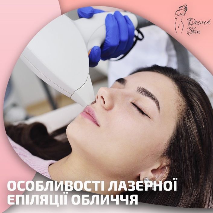 Особливості лазерної епіляції обличчя image