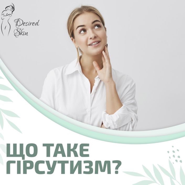 Що таке гірсутизм? image