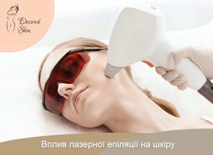 Як лазерна епіляція впливає на шкіру image